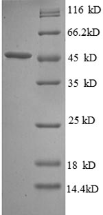 Recombinant Escherichia coli Probable diguanylate cyclase DgcQ (dgcQ), partial