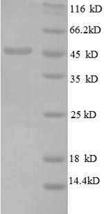Recombinant Escherichia coli 50S ribosomal protein L6 (rplF), partial