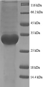 Recombinant Escherichia coli 50S ribosomal protein L35 (rpmI), partial