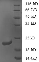 Recombinant Mouse C-X-C motif chemokine 16 (Cxcl16), partial