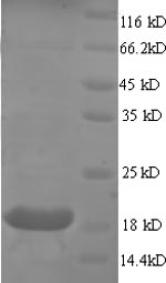 Recombinant Human Myosin regulatory light chain 2, ventricular/cardiac muscle isoform (MYL2), partial