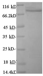 Recombinant Human Angiopoietin-related protein 4 (ANGPTL4), partial