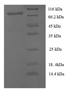 Recombinant Human Cell surface glycoprotein MUC18 (MCAM), partial
