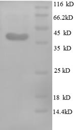 Recombinant Human Midkine (MDK)