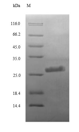Recombinant Human Complement C3 (C3), partial