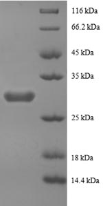 Recombinant Human Peptide YY protein (PYY), partial
