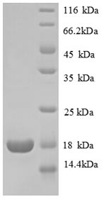 Recombinant Human 60S ribosomal protein L31 (RPL31)
