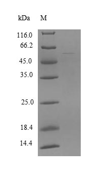Recombinant Human Zinc finger and SCAN domain-containing protein 21 (ZSCAN21), partial
