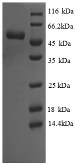 Recombinant Saccharomyces cerevisiae Cystathionine gamma-lyase (CYS3), partial