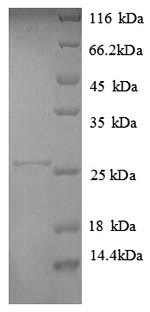 Recombinant Human HLA class II histocompatibility antigen, DP alpha 1 chain (HLA-DPA1), partial