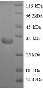 Recombinant Rat Vasopressin V1a receptor (Avpr1a), partial