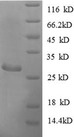 Recombinant Escherichia coli Adenylate kinase (adk)