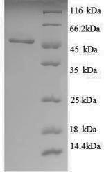 Recombinant Escherichia coli UDP-glucose 6-dehydrogenase (ugd), partial