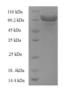 Recombinant Escherichia coli Glucose-6-phosphate 1-dehydrogenase (zwf), partial