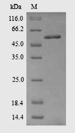 Recombinant Rattus norvegicus Acetyl-CoA carboxylase 1 (Acaca), partial
