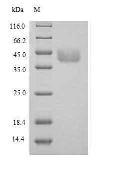 Recombinant Mouse Serine--pyruvate aminotransferase, mitochondrial (Agxt)