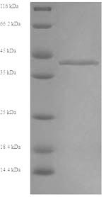 Recombinant Rabbit Fructose-bisphosphate aldolase B (ALDOB)
