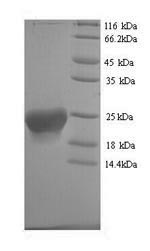 Recombinant Human Putative inactive neutral ceramidase B (ASAH2B)