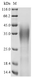 Recombinant Human Ataxin-7 (ATXN7), partial