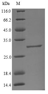 Recombinant Bovine Beta-1,4-galactosyltransferase 1 (B4GALT1), partial