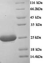 Recombinant Mouse Complement C1q subcomponent subunit A (C1qa)