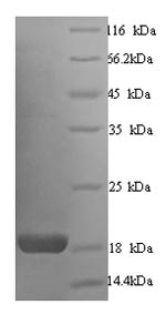 Recombinant Human Calmodulin (CALM1)