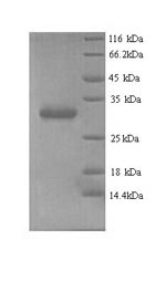 Recombinant Human Chromobox protein homolog 7 (CBX7)