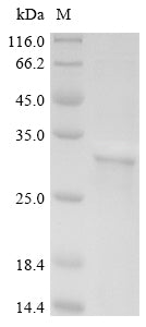 Recombinant Human Cerebellar degeneration-related antigen 1 (CDR1)