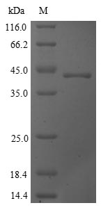 Recombinant Saccharomyces cerevisiae Cystathionine gamma-lyase (CYS3), partial
