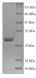 Recombinant Human Cathepsin K (CTSK)
