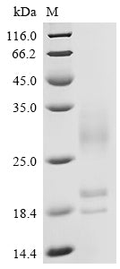 Recombinant Human C-X-C chemokine receptor type 5(CXCR5), partial