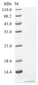 Recombinant Human C-X-C chemokine receptor type 5(CXCR5), partial