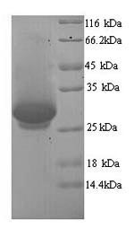 Recombinant Human Dynamin-1 (DNM1), partial