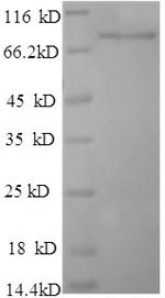 Recombinant Rat Dipeptidyl aminopeptidase-like protein 6 (DPP6), partial
