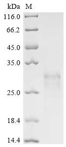 Recombinant Human Eukaryotic translation initiation factor 4E (EIF4E)