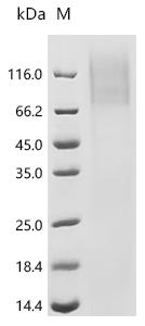 Recombinant Human Eosinophil peroxidase (EPX)