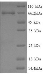 Recombinant Pig Electron transfer flavoprotein-ubiquinone oxidoreductase, mitochondrial (ETFDH)