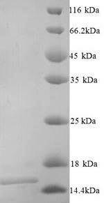 Recombinant Mouse Frataxin,mitochondrial (Fxn), partial