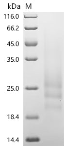 Recombinant Mouse Gastric inhibitory polypeptide receptor(Gipr), partial