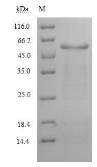 Recombinant Human Alanine aminotransferase 1 (GPT)