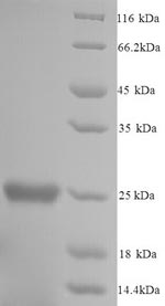 Recombinant Mouse Glutathione S-transferase P 1 (Gstp1)