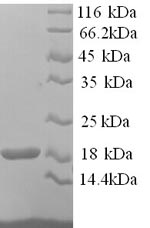 Recombinant Mouse Hemoglobin subunit alpha (Hba)