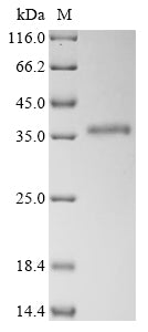 Recombinant Human Heterogeneous nuclear ribonucleoproteins A2/B1 (HNRNPA2B1)