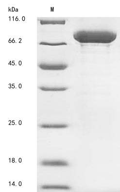 Recombinant Human Heat shock cognate 71 kDa protein (HSPA8)