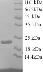 Recombinant Mouse Integrin alpha-L (Itgal), partial