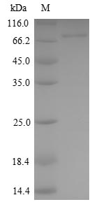 Recombinant Human Kelch-like ECH-associated protein 1 (KEAP1)