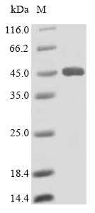 Recombinant Human Lysosomal acid lipase/cholesteryl ester hydrolase (LIPA)