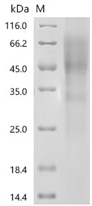 Recombinant Human Microtubule-associated protein tau（MAPT)