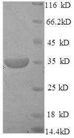 Recombinant Human DNA-3-methyladenine glycosylase (MPG), partial