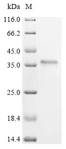 Recombinant Human 28S ribosomal protein S21, mitochondrial (MRPS21)